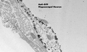 hippocampal neurons