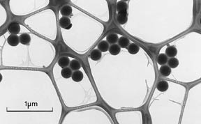 lacey support film electron microscopy grid