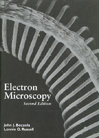 electron microscopy