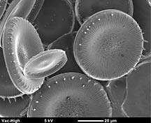 Diatomes micrograph