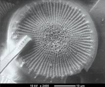 Diatoms micrograph