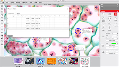 Motic Images Advanced 3.2 3-D Image Presentation