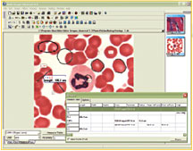 Motic Images Advanced 3.2 Measuring Functions