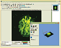 Motic Images Advanced 3.2 3-D Image Presentation