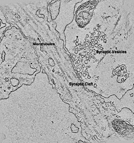 synaptic vesicles and microtubules can be clearly discerned