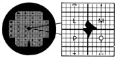 Maxtaform style H7 TEM Grid