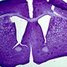 Cresyl Violet 50μm - C. Meshul - Portland VAMC