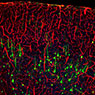 EB+GFAP+DAPI - 50μm - P. Nahirney