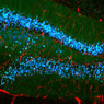 EB+GFAP+DAPI - 50μm - P. Nahirney