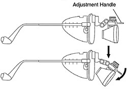 Surgical Loupe Angle Adjustment