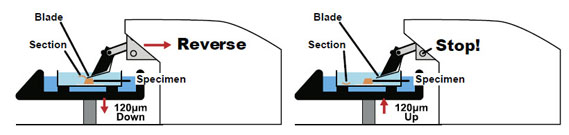 retraction mechanism