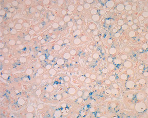 Iron-Prussian Blue Stain for Ferric Iron  -  Microwave Procedure