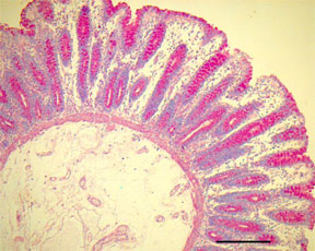 Iron-Prussian Blue Stain for Ferric Iron - Microwave Procedure