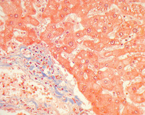 Collagen & Smooth Muscle – Masson's Trichrome Stain - Microwave Procedure